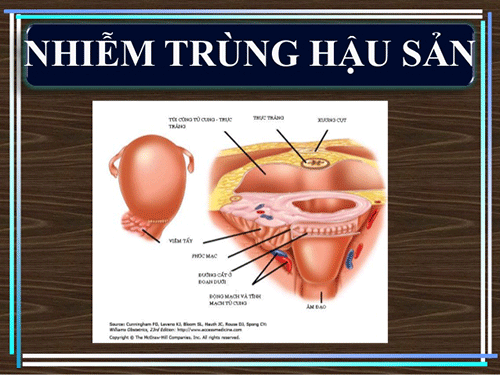 Nhiễm trùng hậu sản - Hình ảnh minh họa